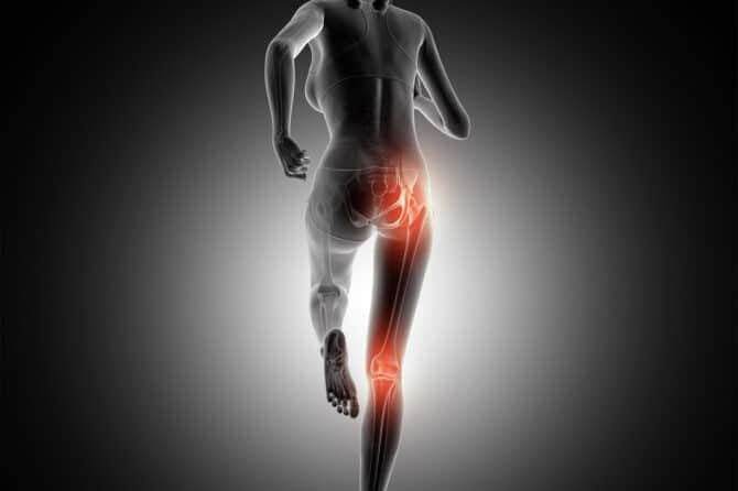 Síndrome del Piriforme: Definición, Diagnóstico y Abordaje Fisioterapéutico